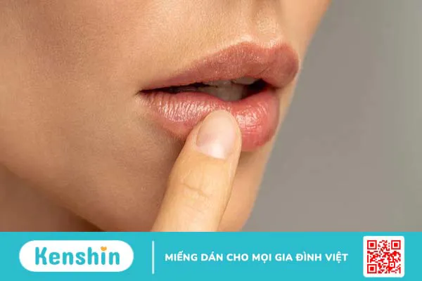 Các bệnh về môi: Nguyên nhân, triệu chứng và điều trị