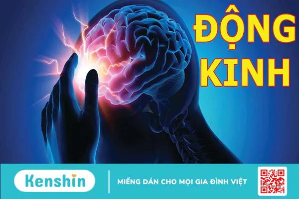 Các biến chứng động kinh là gì? Mối liên hệ giữa rối loạn tâm thần và động kinh