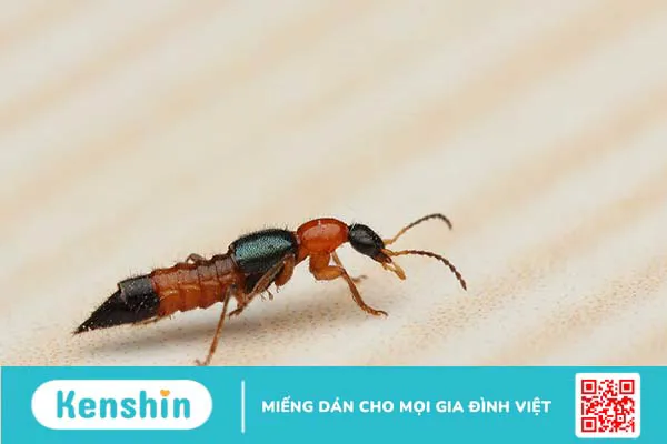 Các bước xử lý và cách trị kiến ba khoang cắn