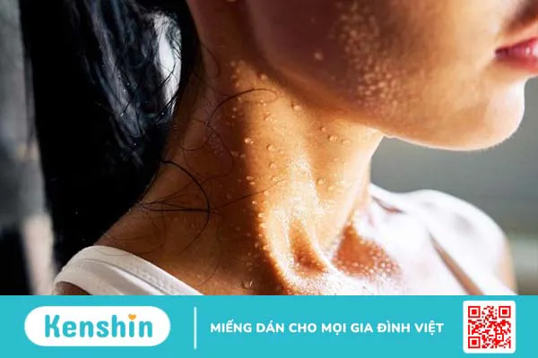 Các cách nhận biết cơ thể đang đốt mỡ thừa