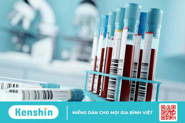 Các chỉ số trong xét nghiệm máu gồm những gì và có ý nghĩa như thế nào?