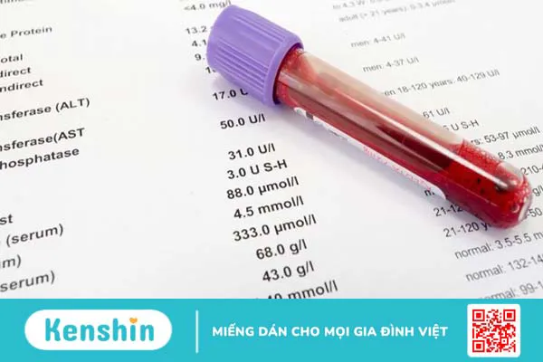 Các chỉ số trong xét nghiệm máu gồm những gì và có ý nghĩa như thế nào?