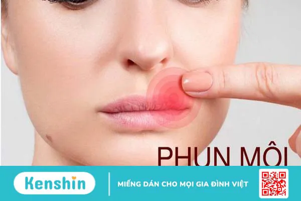 Các dấu hiệu môi bị viêm sau phun