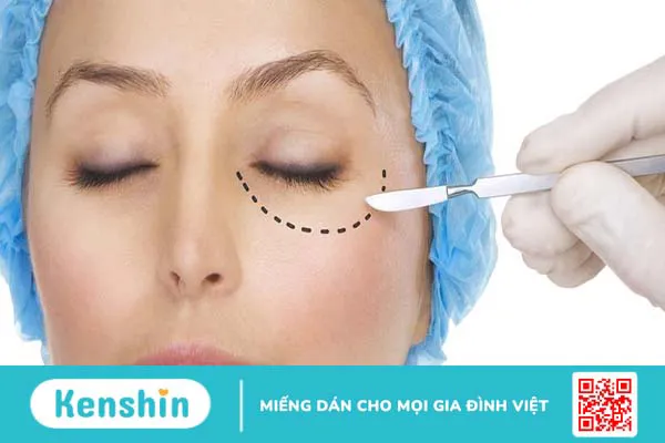 Các kiểu mắt phổ biến hiện nay và tầm quan trọng của kiểu mắt 4