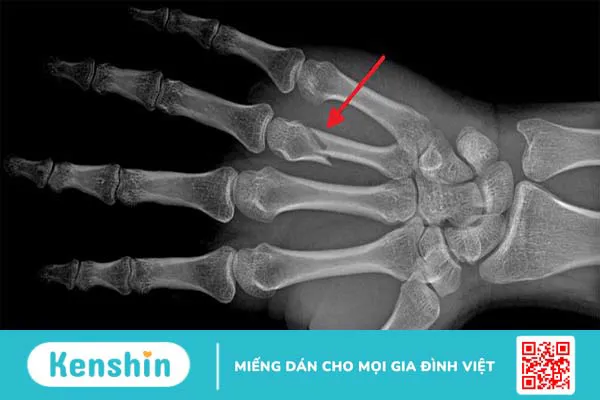 Các kỹ thuật chẩn đoán hình ảnh phổ biến hiện nay 3