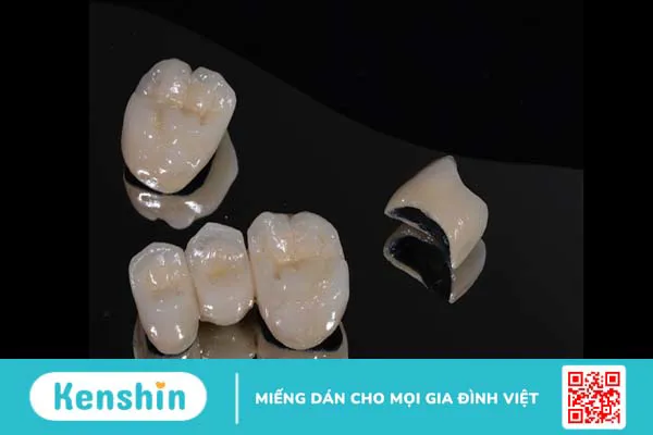 Các loại răng sứ thẩm mỹ phổ biến hiện nay