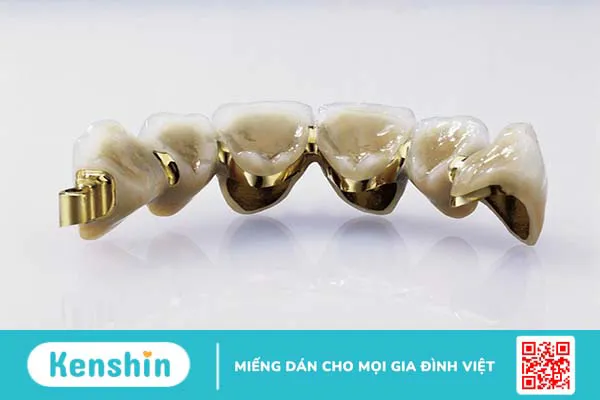 Các loại răng sứ thẩm mỹ phổ biến hiện nay