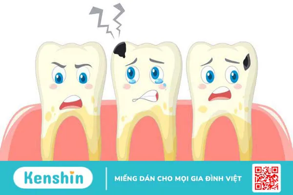 Các phương pháp chữa sâu răng cho trẻ 4 tuổi hiệu quả 2