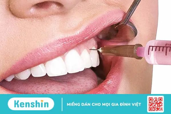 Các phương pháp gây tê thường dùng và một số vấn đề cần lưu ý về kỹ thuật gây tê