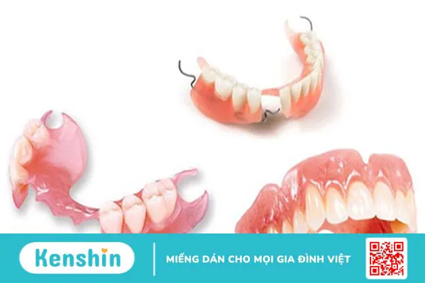 Các phương pháp trồng răng hiệu quả nhất hiện nay 1