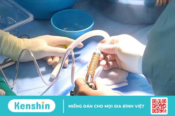 thiết bị tim cấy ghép 1