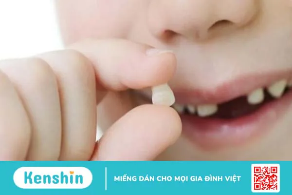 Cách bảo quản răng sữa sau khi nhổ và một số điều cần biết