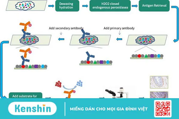 Cách đọc kết quả hóa mô miễn dịch như thế nào?