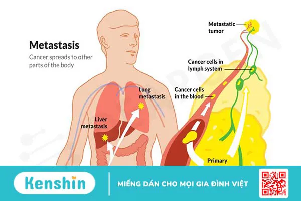 Cách đọc kết quả hóa mô miễn dịch như thế nào?