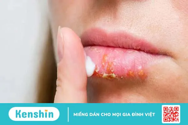 Cách dưỡng môi ban đêm cho đôi môi căng mọng, hồng hào 2