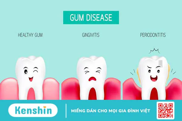 Cách giảm đau răng sau khi lấy tủy hiệu quả mà bạn có thể tham khảo