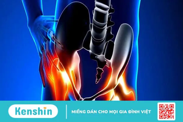 Cách làm giảm đau cơ háng nhanh chóng tại nhà ai cũng nên biết