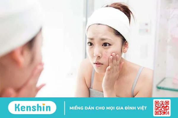 Cách làm mặt nạ ngũ hoa với sữa tươi không đường