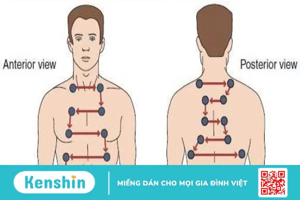 Cách nghe phổi bằng ống nghe được thực hiện ra sao? 3