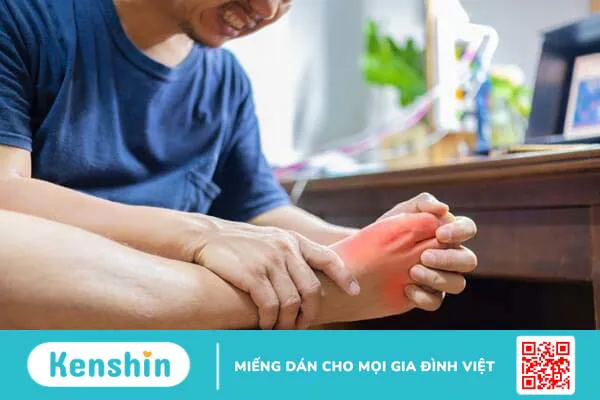 Cách trị mắt cá dưới lòng bàn chân tránh nguy cơ nhiễm trùng