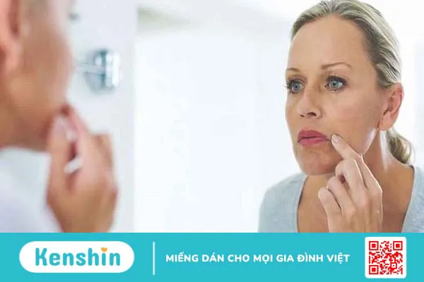 Cách trị viêm môi dị ứng tại nhà có hiệu quả không?