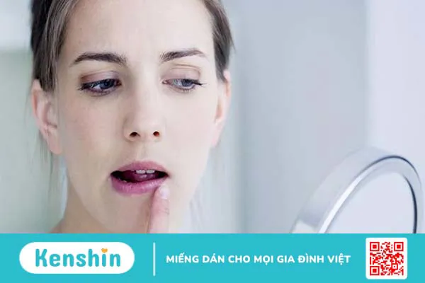 Cách trị viêm môi dị ứng tại nhà có hiệu quả không?