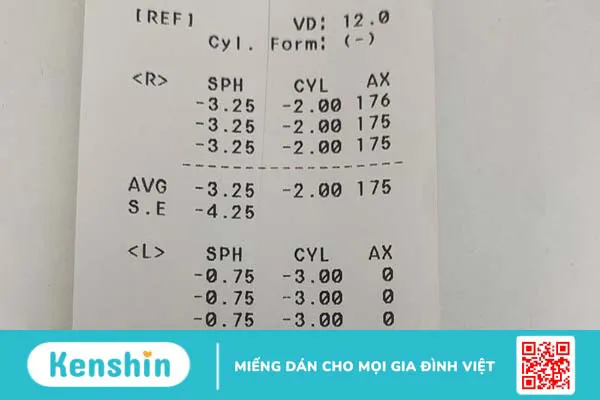 Cách xem độ cận trên giấy: Hướng dẫn chi tiết cho người mới