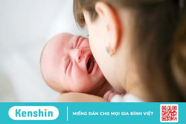 Cách xử lý lông mi quặm ở trẻ sơ sinh chính xác và an toàn