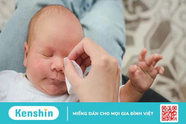 Cách xử lý lông mi quặm ở trẻ sơ sinh chính xác và an toàn 3