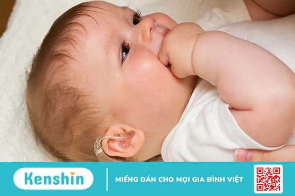 Câm bẩm sinh có bị điếc không? Cách phát hiện trẻ bị điếc và phương pháp điều trị 3