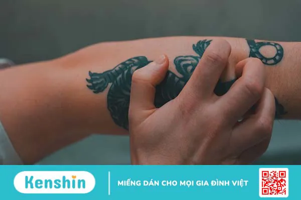 Cảm giác vùng da hình xăm bị ngứa phải làm sao?