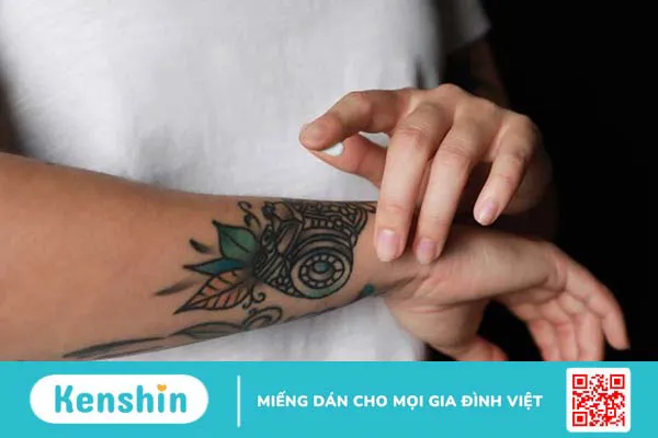 Cảm giác vùng da hình xăm bị ngứa phải làm sao?