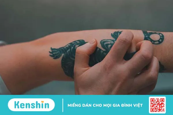 Cảm giác vùng da hình xăm bị ngứa phải làm sao?