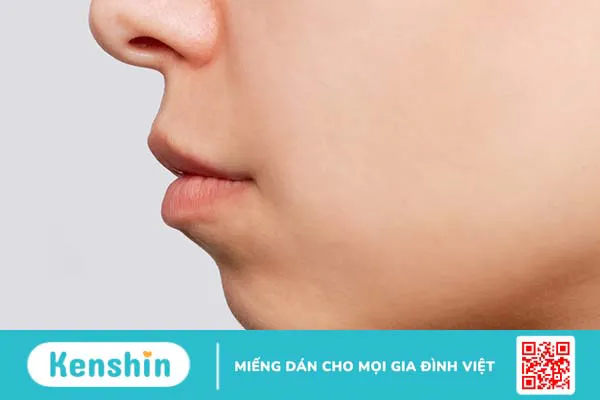 Cằm lẹm: Nguyên nhân, dấu hiệu nhận biết và cách khắc phục