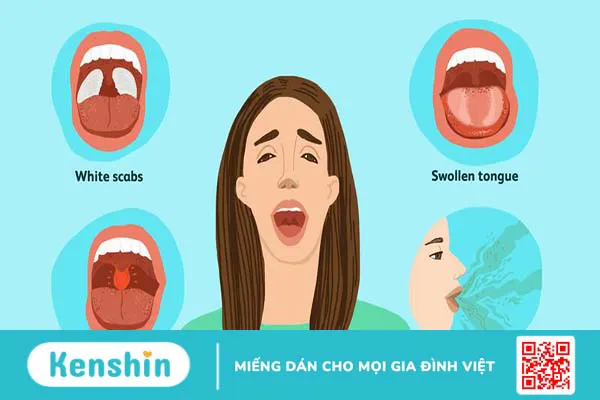 Cắt amidan có ảnh hưởng gì không? Bao lâu thì lành lại?