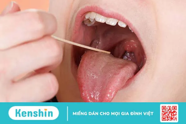 Cắt amidan có ảnh hưởng gì không? Bao lâu thì lành lại?