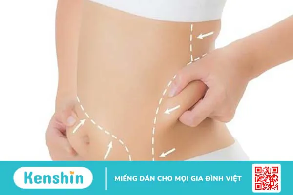 Cắt da thừa sau khi giảm cân ở vùng bụng dưới