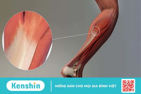 Cấu tạo và chức năng của gân đối với cơ thể con người