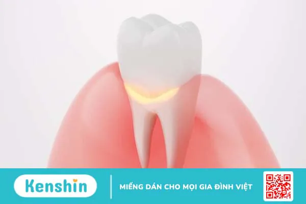 Cấu tạo và chức năng của nướu răng