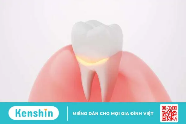 Cấu tạo và chức năng của nướu răng