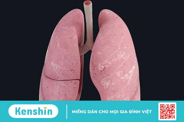 Cấu trúc giải phẫu phổi và chức năng của phổi