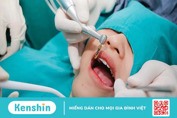 Cấy ghép Zygoma Implant có an toàn không? 1