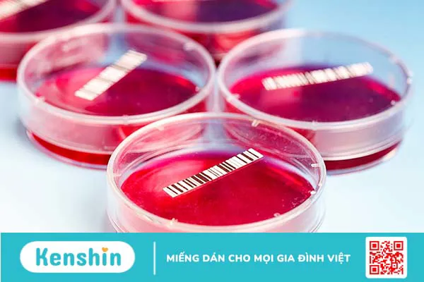 Cấy máu – Xét nghiệm xác định tình trạng nhiễm khuẩn huyết