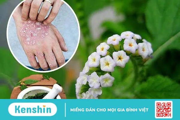 Cây vòi voi chữa vảy nến có hiệu quả không?