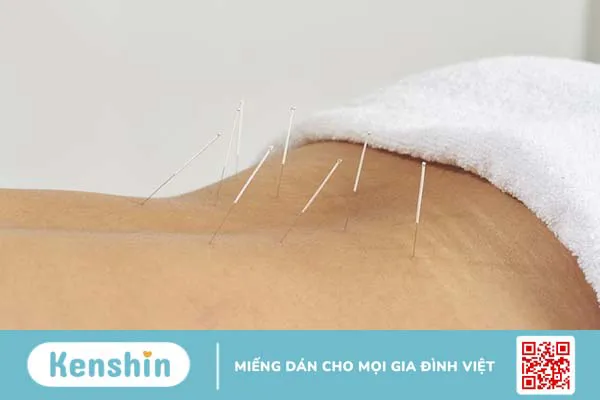 Châm cứu bấm huyệt mang lại lợi ích gì cho sức khỏe?