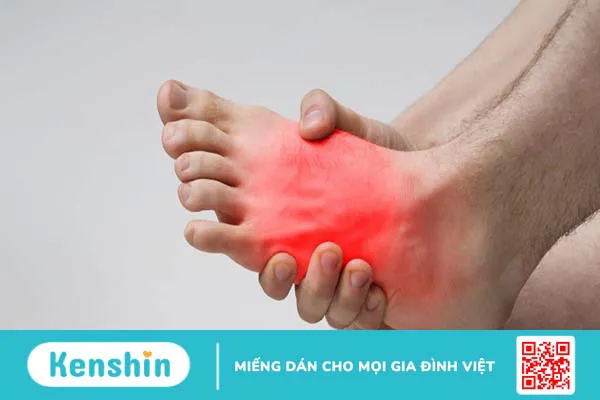 Chân bị sưng đau nhức ở vùng mu bàn chân là bệnh gì?