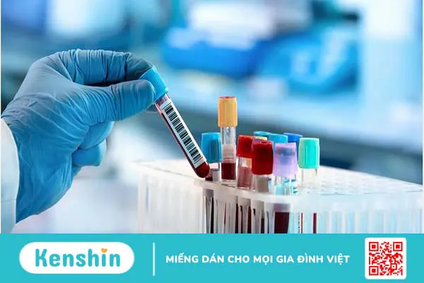 Chẩn đoán ngoại vi là gì? Ưu điểm của chẩn đoán ngoại vi