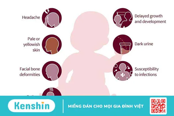 Chẩn đoán và điều trị Thalassemia