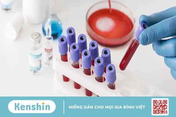 Chẩn đoán và điều trị Thalassemia