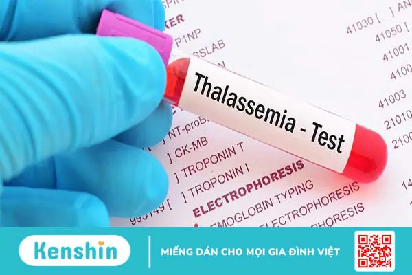 Chẩn đoán và điều trị Thalassemia